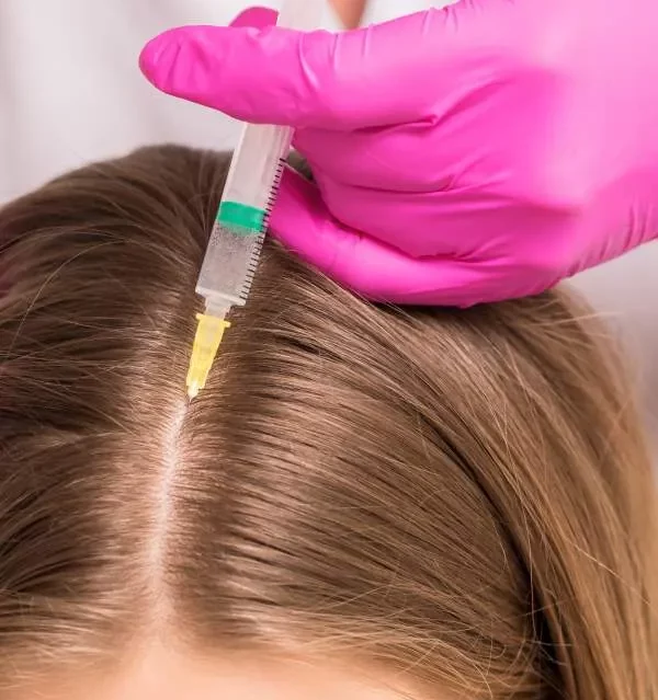 Stem Cells Hair Restoration