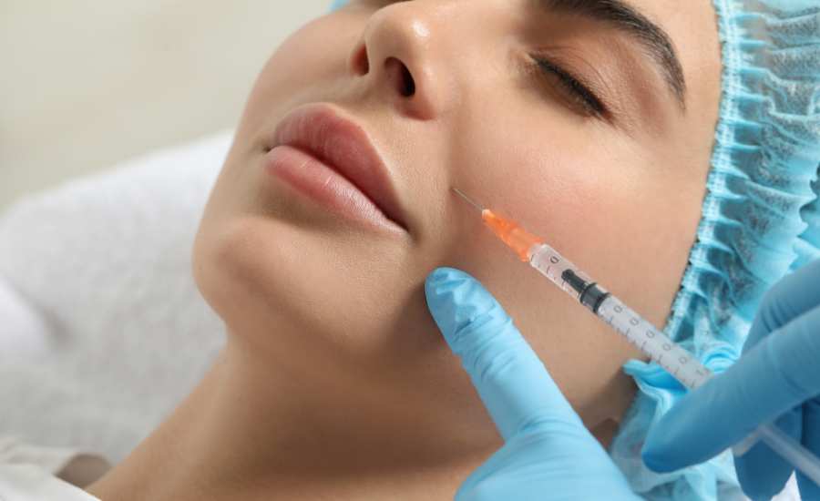 Marionette Lines Injection